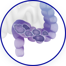 Каловый комок 2