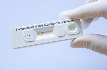 Бактериологическое экспресс-тестирование