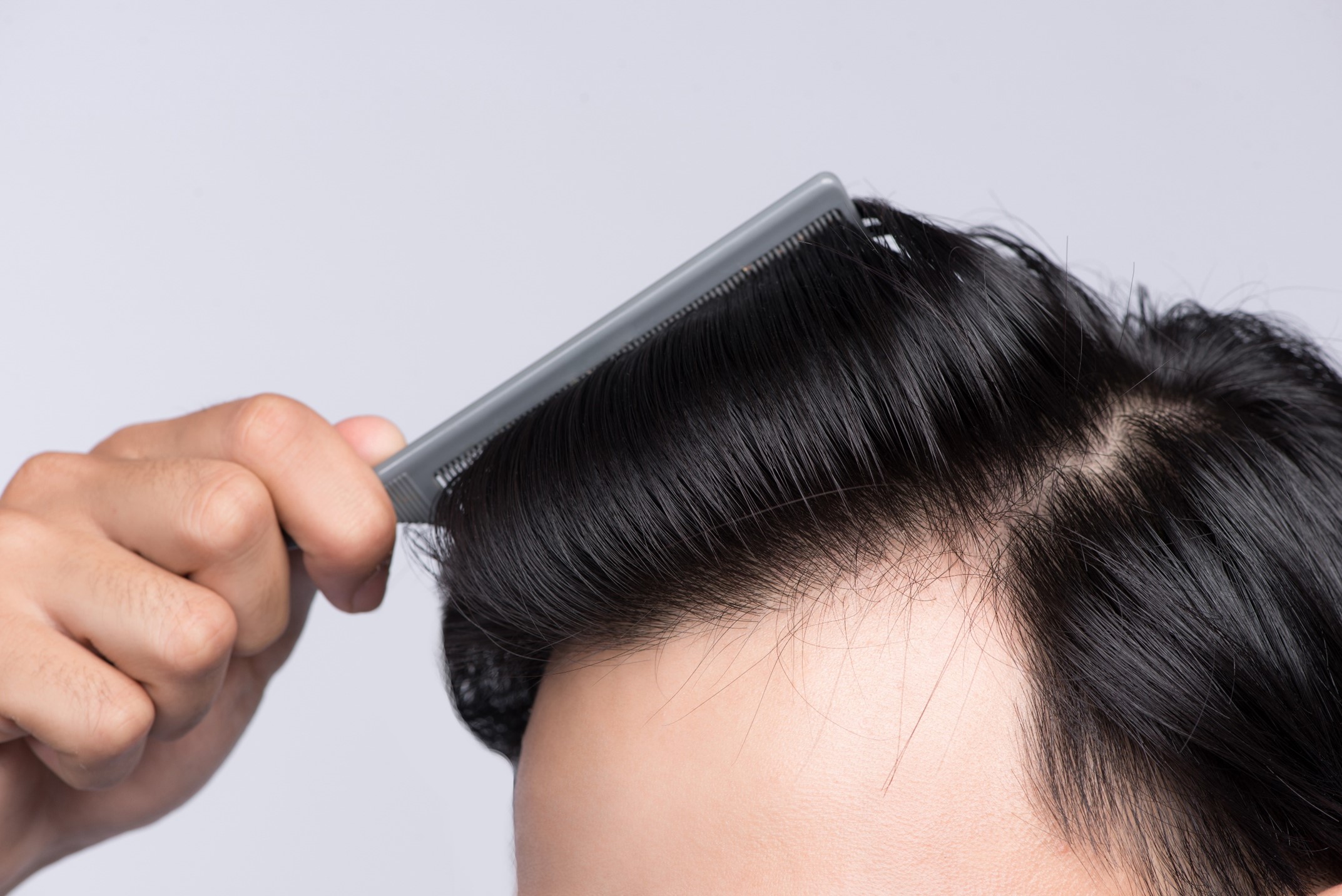prevent excessive brushing to control oily scalp