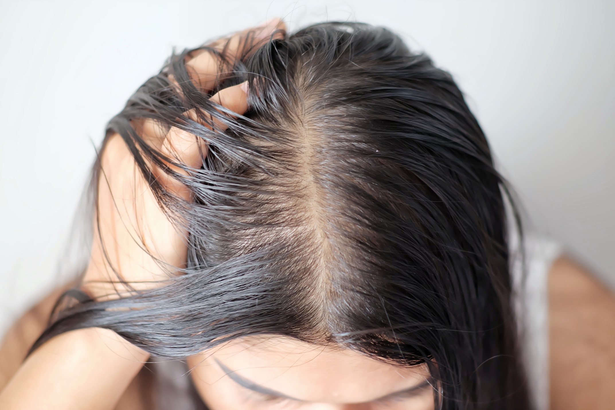 Control oily hair and scalp to prevent hair problems