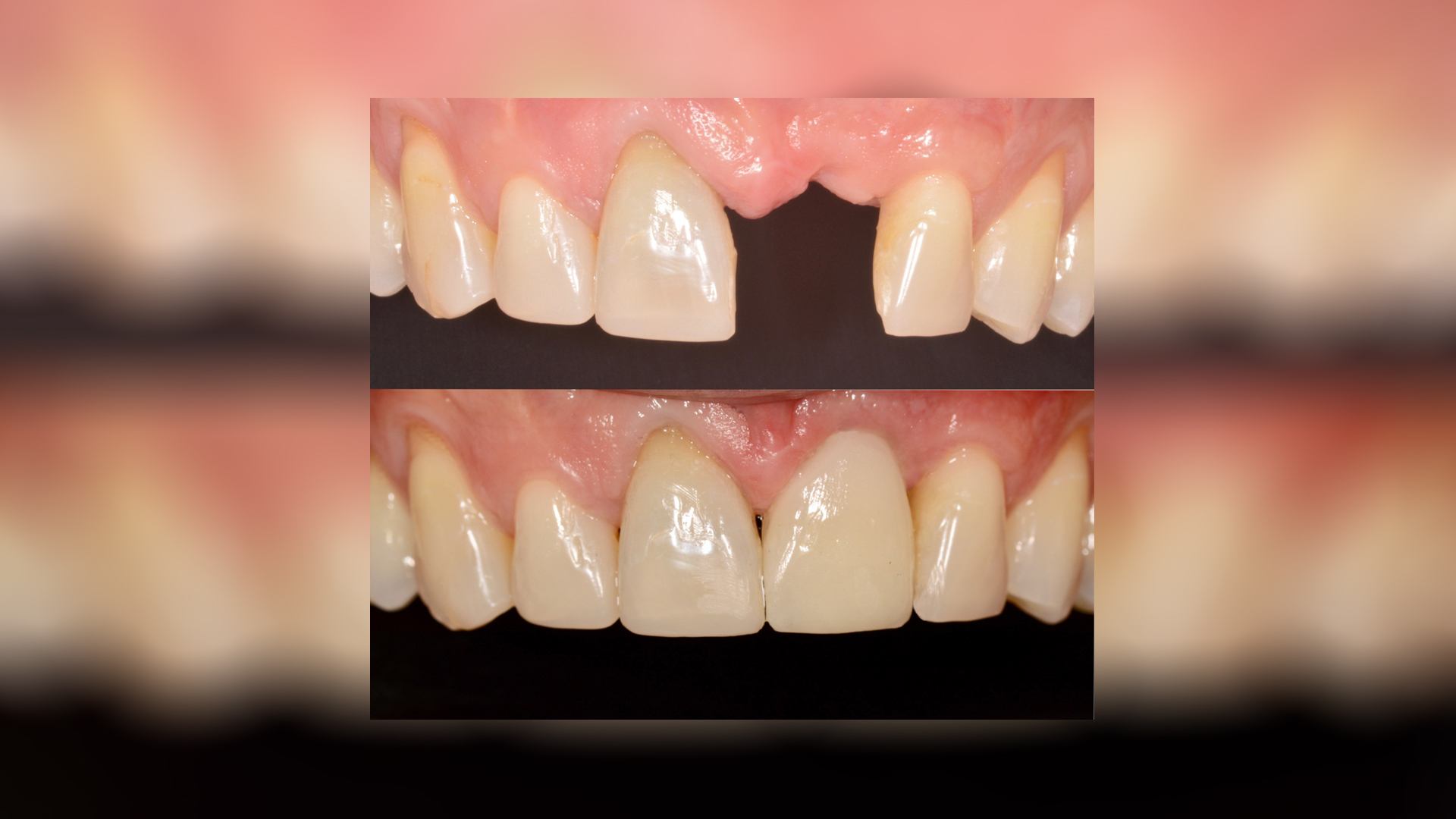 Αρχική και τελική κατάσταση