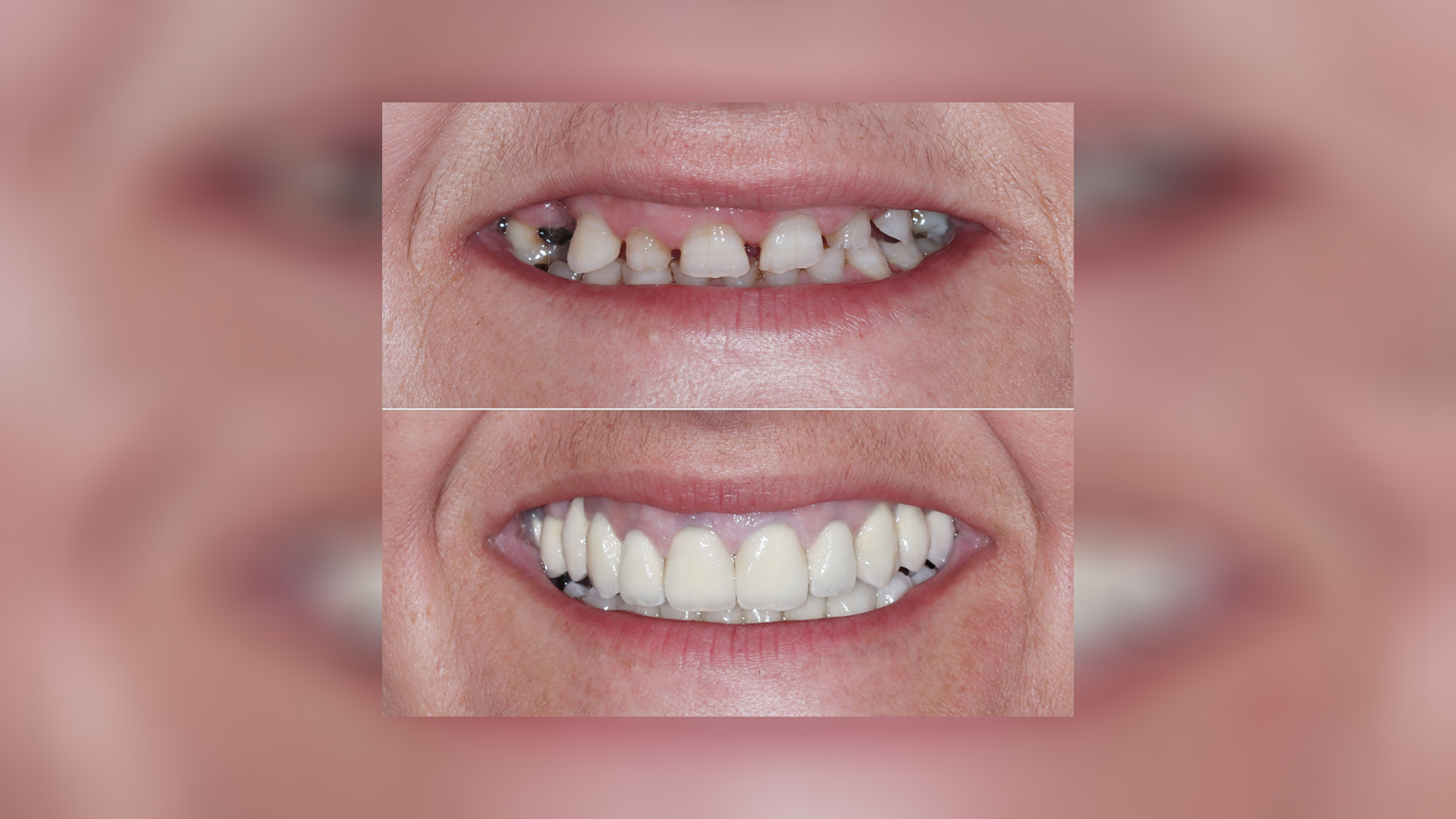 Αισθητική βελτίωση – Από το πριν στο μετά