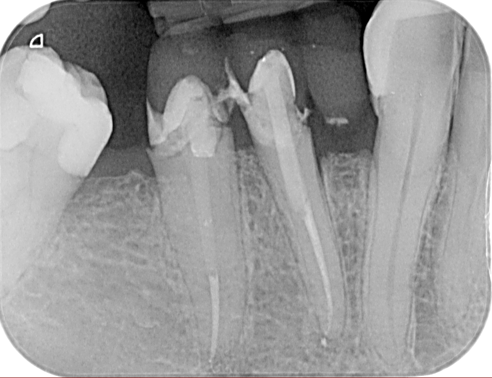 Τελ ική κατάσταση