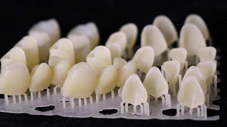 Η τεχνολογία 3D printing συμβάλλει στη δημιουργία ακριβέστερων και ελάχιστα επεμβατικών προσωρινών αποκαταστάσεων για φυσικό αισθητικό αποτέλεσμα.