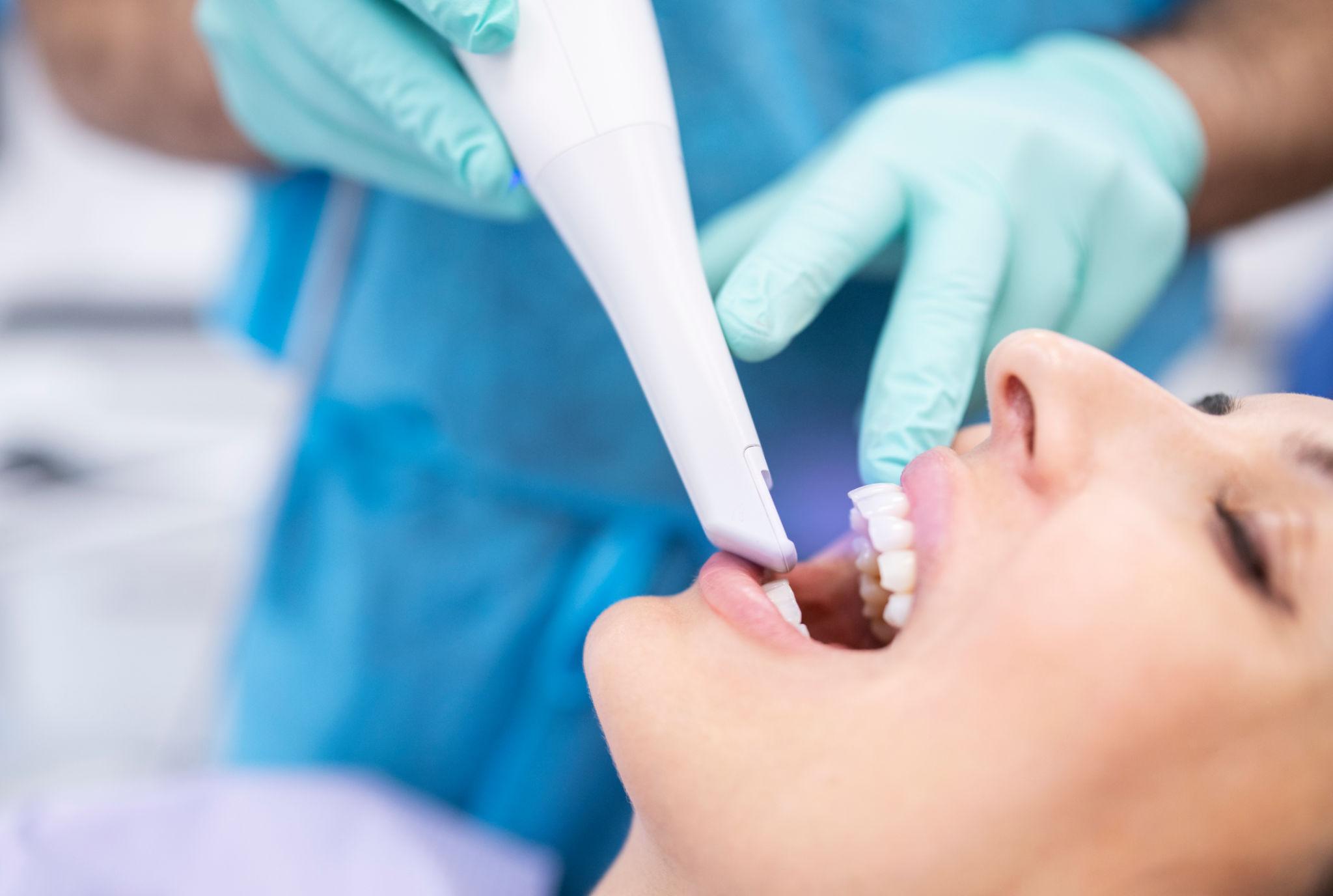 Το ενδοστοματικό scanner επιτρέπει στον Dr. Κληρονόμος να πραγματοποιεί ψηφιακά αποτυπώματα χωρίς δυσφορία, βελτιώνοντας την εμπειρία και την ακρίβεια της θεραπείας.