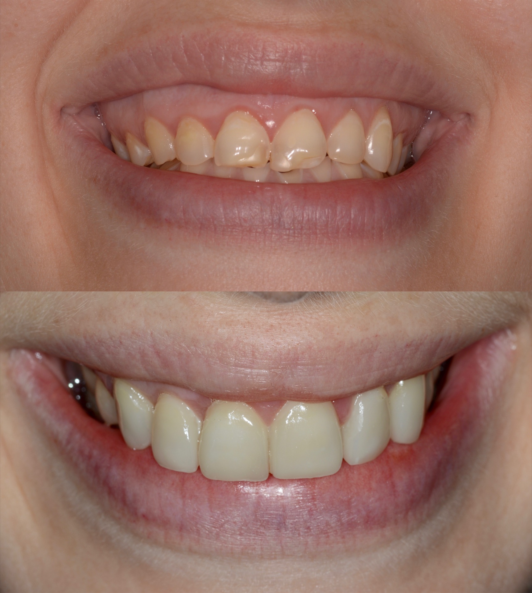 Αρχική και τελική κατάσταση