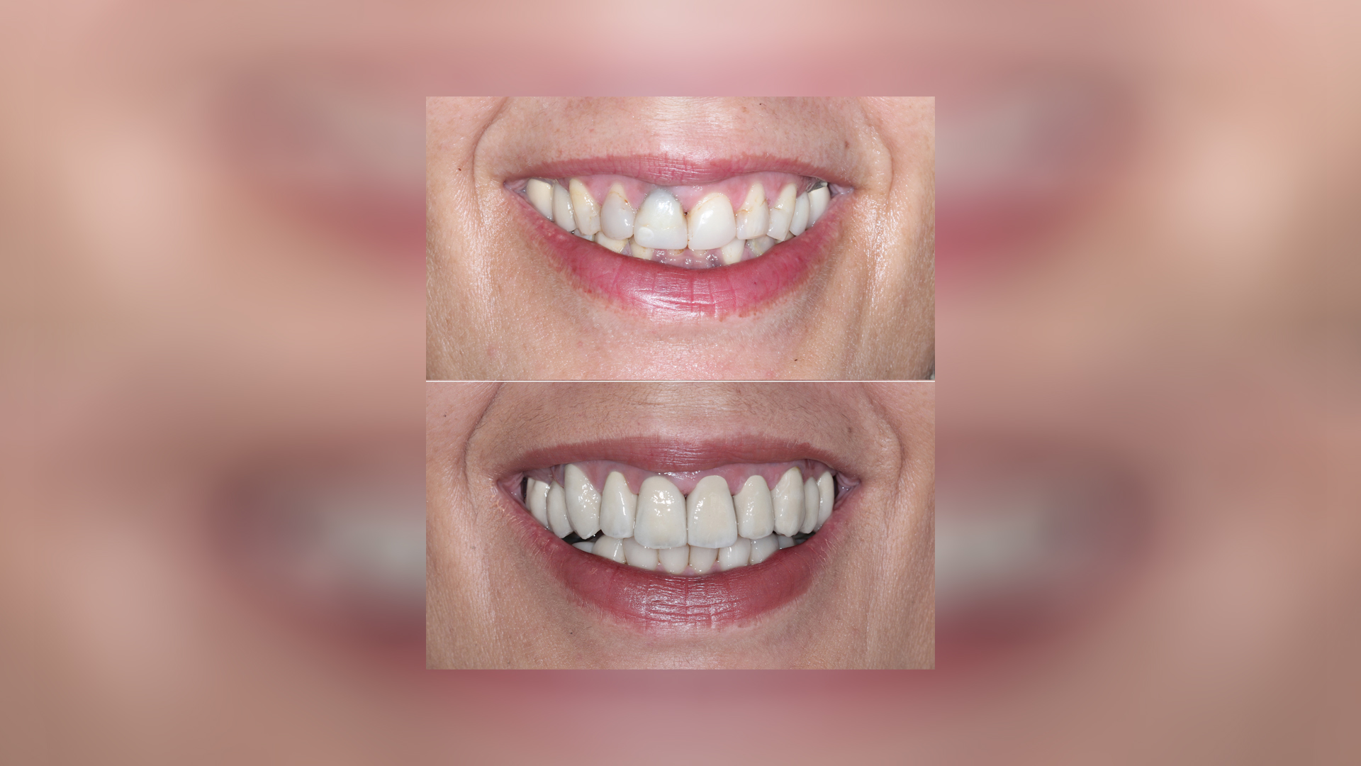 Αισθητική βελτίωση – Από το πριν στο μετά