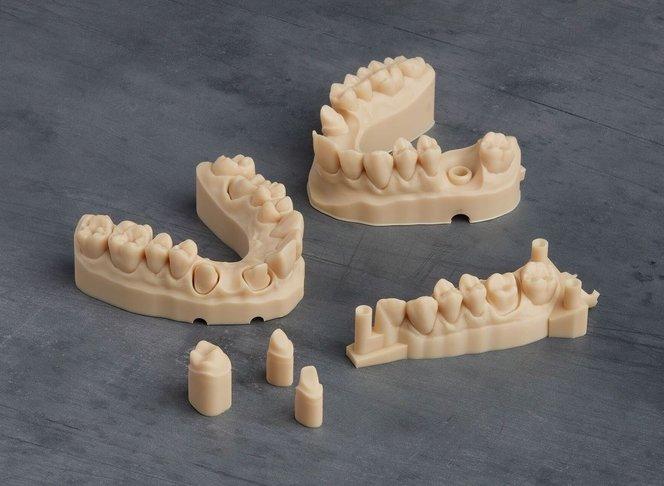 Τα 3D εκτυπωμένα μοντέλα βοηθούν στον καλύτερο σχεδιασμό και την προσαρμογή αισθητικών και προσθετικών αποκαταστάσεων στην σύγχρονη οδοντιατρική.