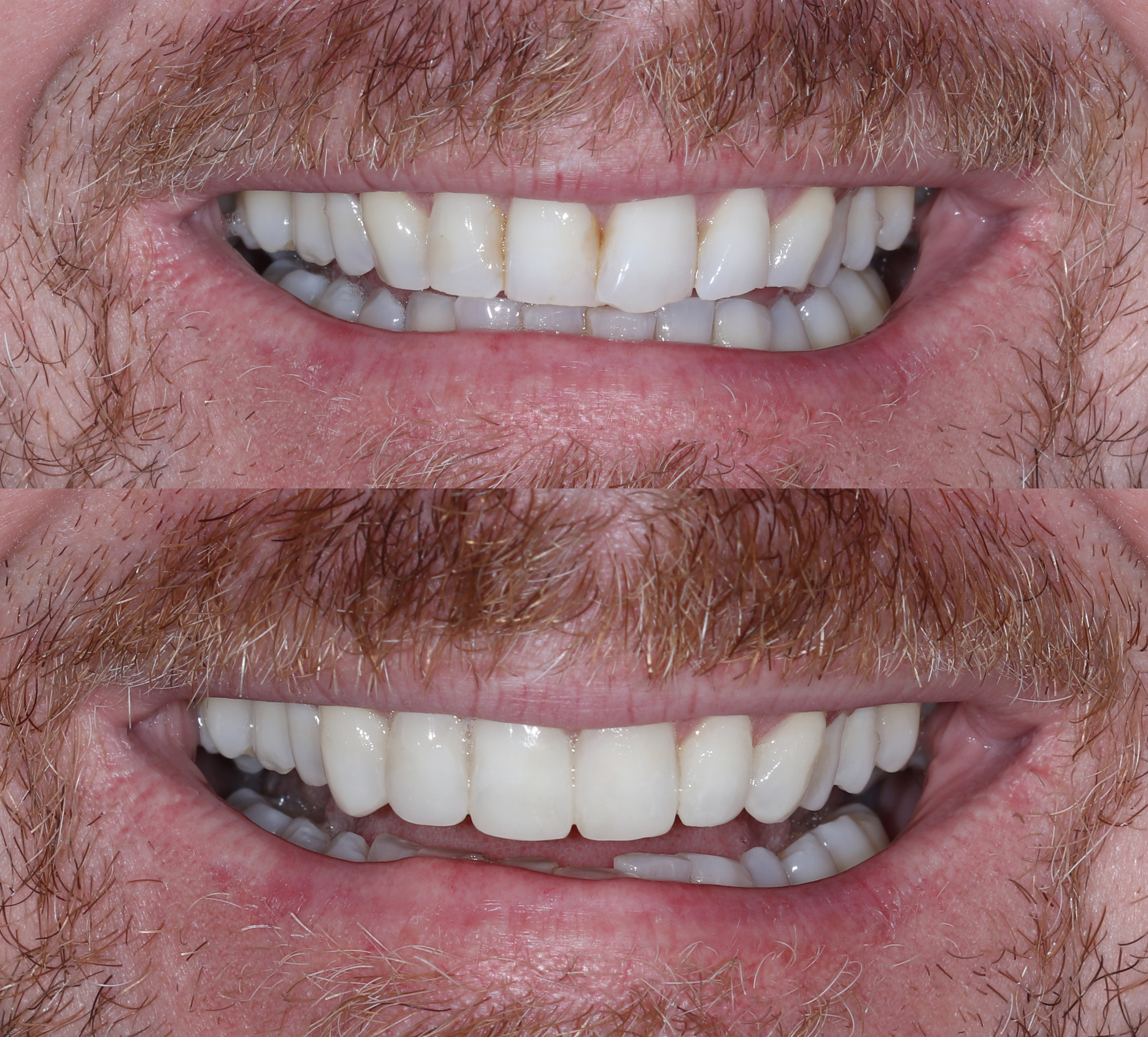 Σύγκριση αρχικής και τελικής κατάστασης – Χαμόγελο