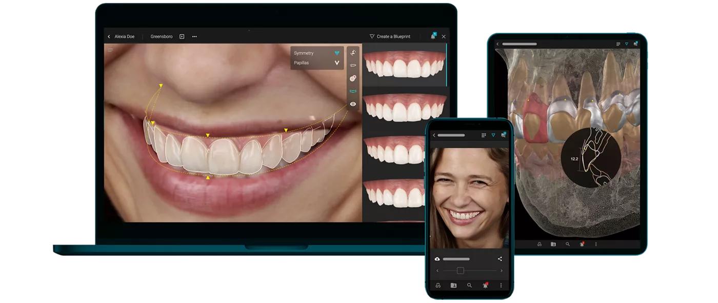 Το Face-Driven Smile Design βασίζεται στη σχέση δοντιών, χειλιών και χαρακτηριστικών προσώ που για έναν πλήρως εξατομικευμένο σχεδιασμό χαμόγελου.