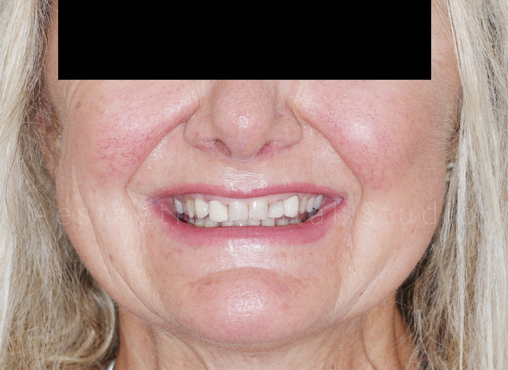 Από τον ψηφιακό σχεδιασμό στο τελικό αποτέλεσμα – 1ο στάδιο – Αρχική κατάσταση