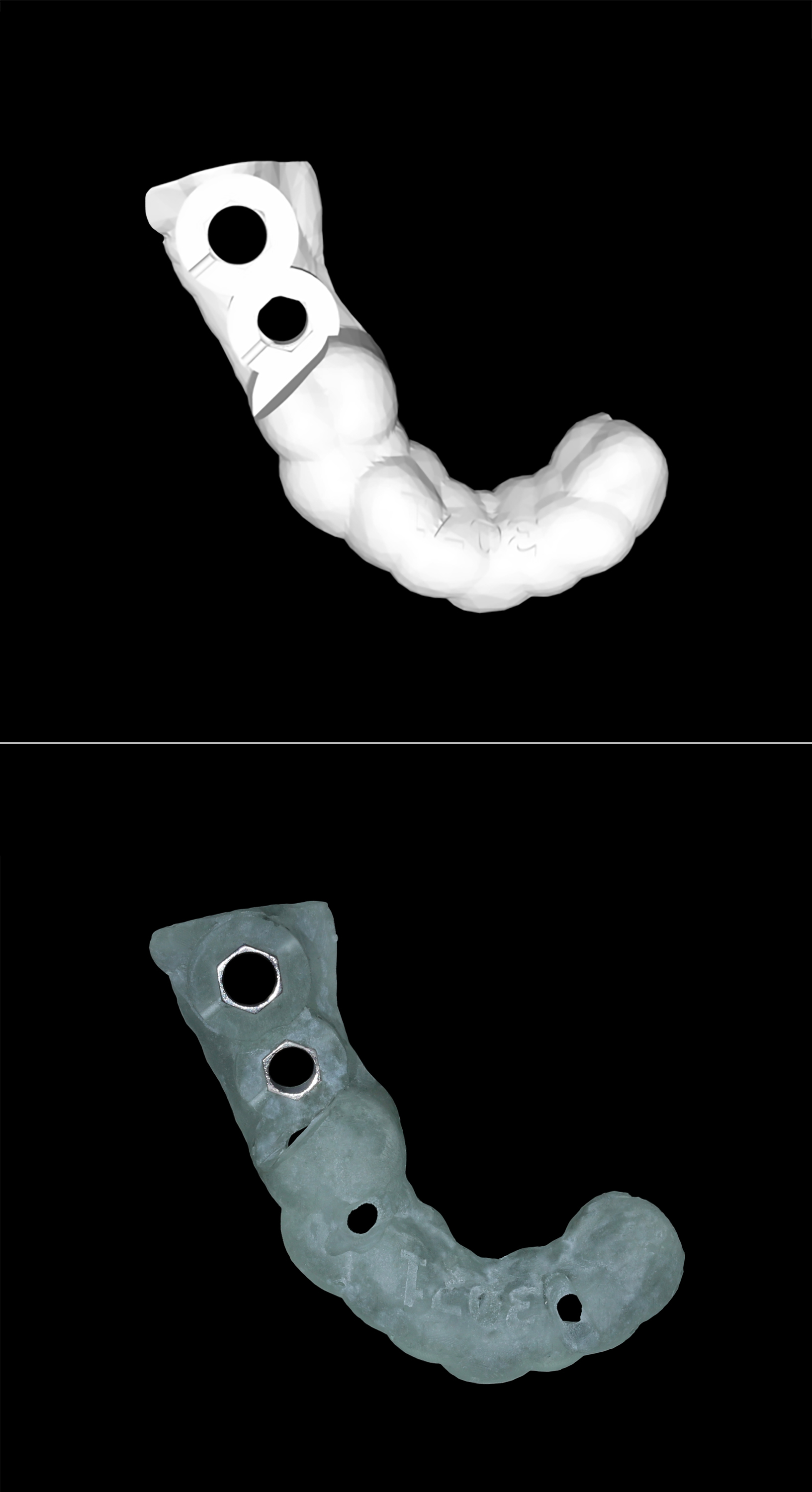 Πάνω: Το ψηφιακό αρχείο του χειρουργικού νάρθηκα - Κάτω: Ο χειρουργικός νάρθηκας εκτυπωμένος από 3D εκτυπωτή