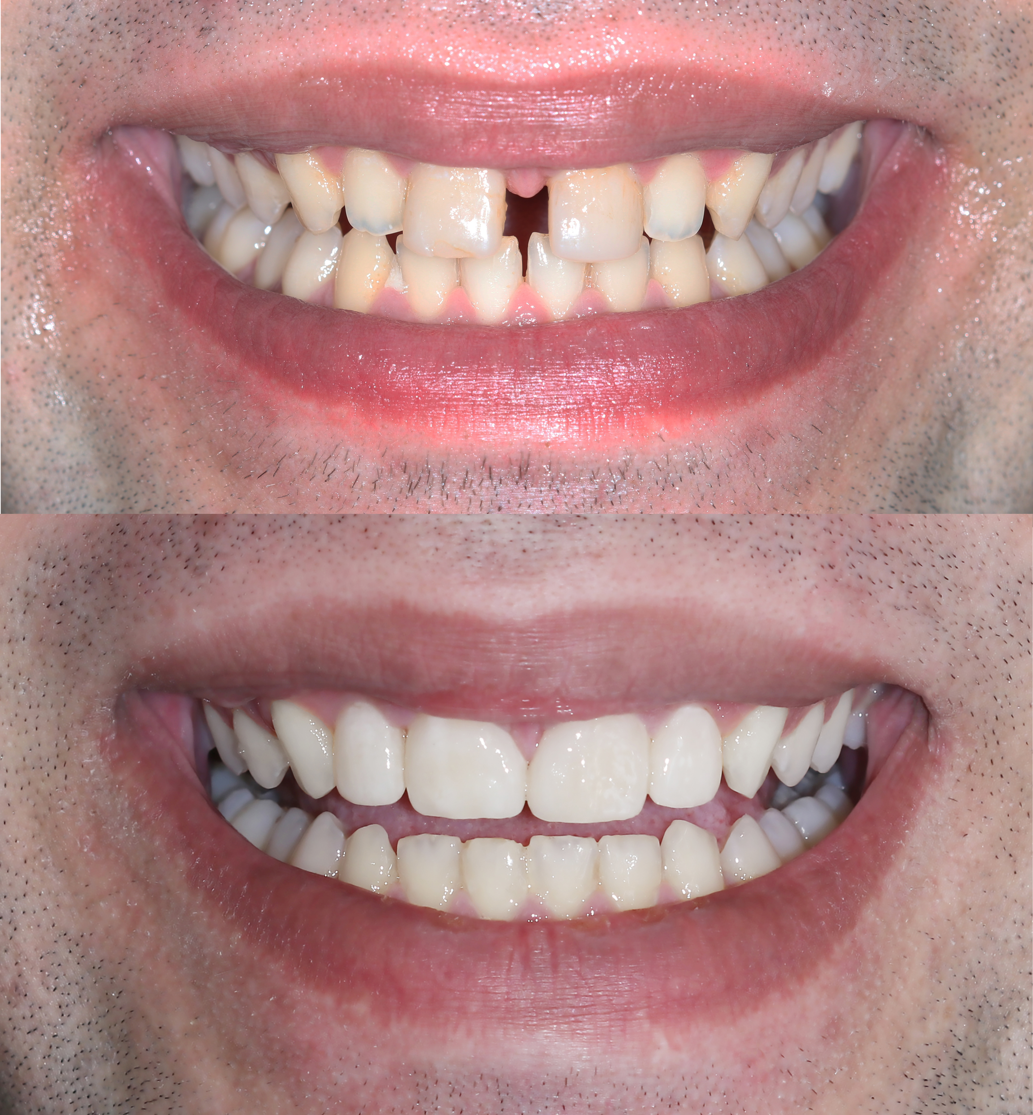 Αρχική και τελική κατάσταση