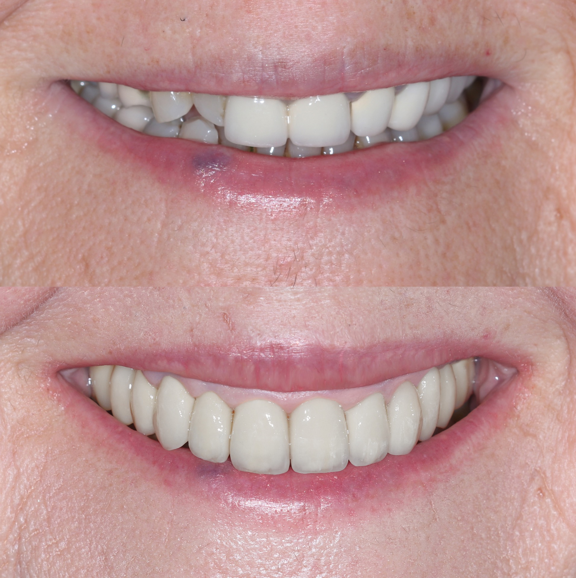 Αρχική και τελική κατάσταση