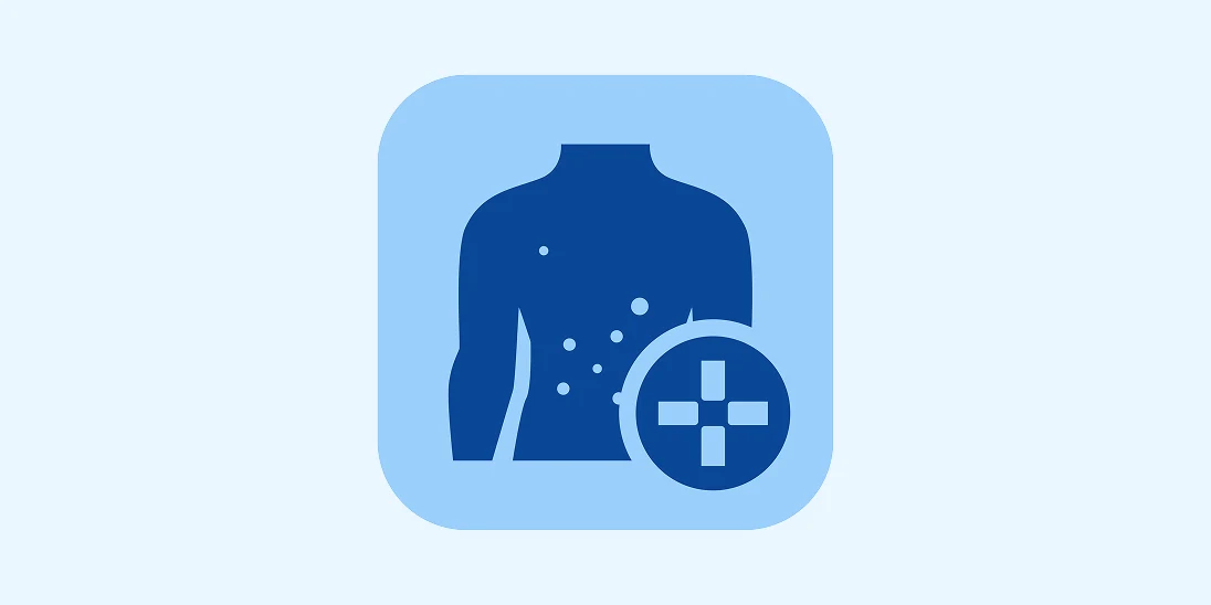 Experiencing irritated and inflamed skin? Our pharmacists offer consultations and effective treatments for minor skin conditions. Available at select pharmacies