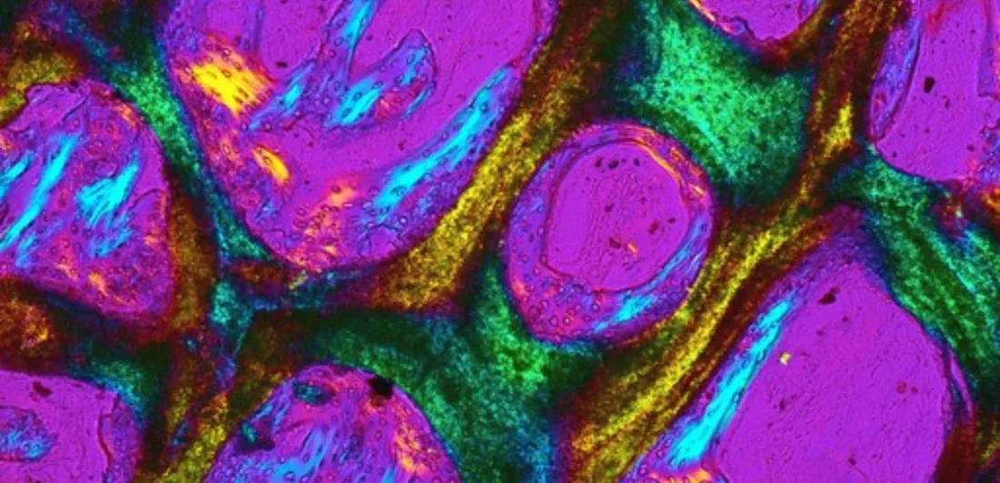 Colourful patterns which show new bone growth under a microscope