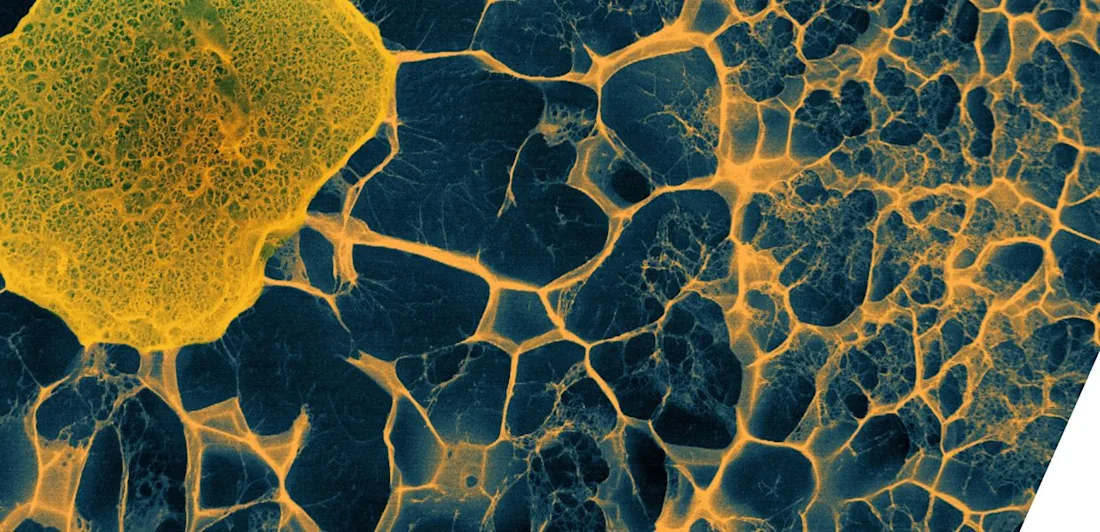 Human stem cell