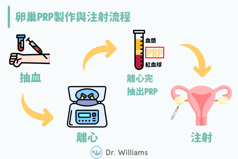 卵巢PRP注射療法：提升卵子數量和囊胚品質，增加成功契機