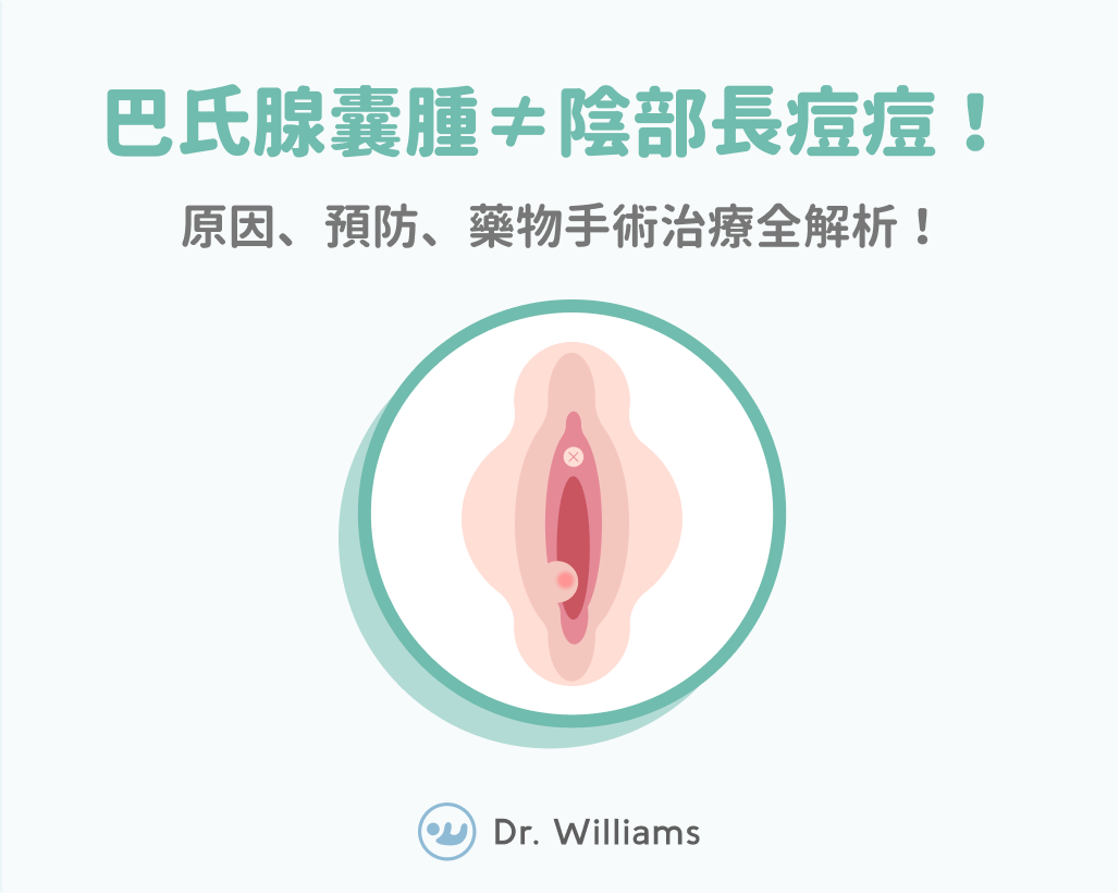 怎麼讓巴氏腺囊腫自然好 預防 藥物手術治療全解析 婦產科專業醫師