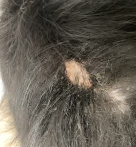 Hot spot with discharge