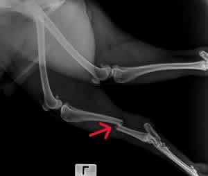 X-ray showing a broken bone