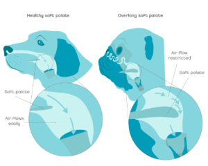 Overlong soft palate