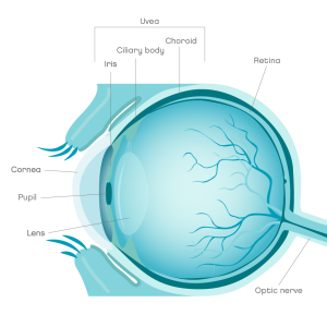 Uveitis in cats