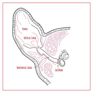 An aural haematoma affects the ear flap or "pinna" in cats