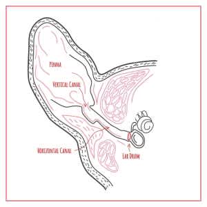 An aural haematoma affects the ear flap or "pinna" in cats