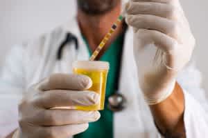 Urine tests in dogs