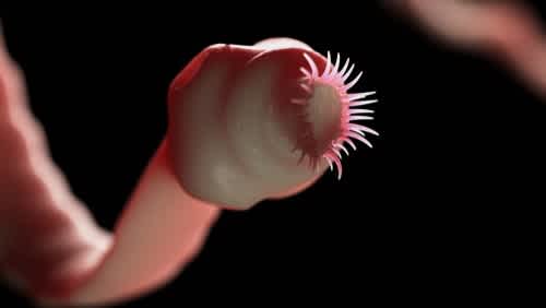 Tapeworm