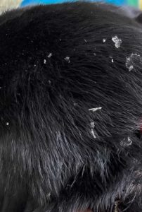 "Walking dandruff" is one of the signs
