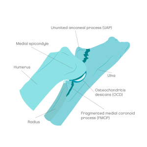 Anatomy of the elbow