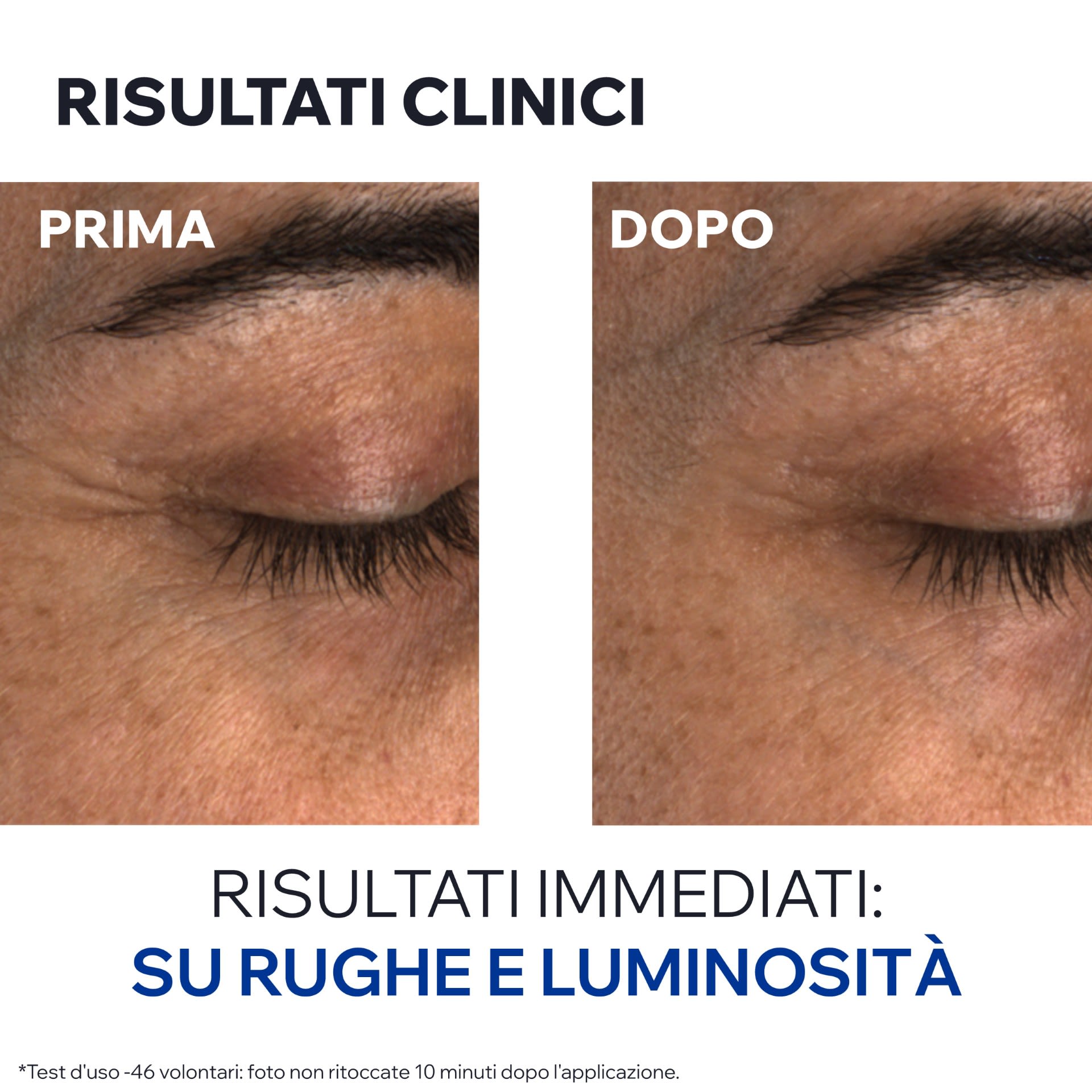 951122807 - AGE ABSOLU BALSAMO CONTORNO OCCHI 15 ML - 4842822_18.jpg