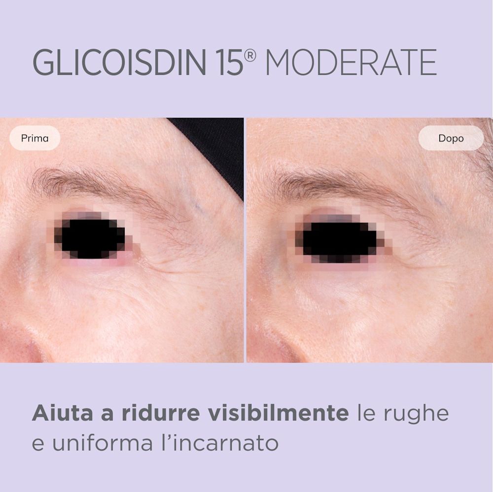 943314005 - GLICOISDIN 15 MODER GEL 50 ML - 4744100_9.jpg