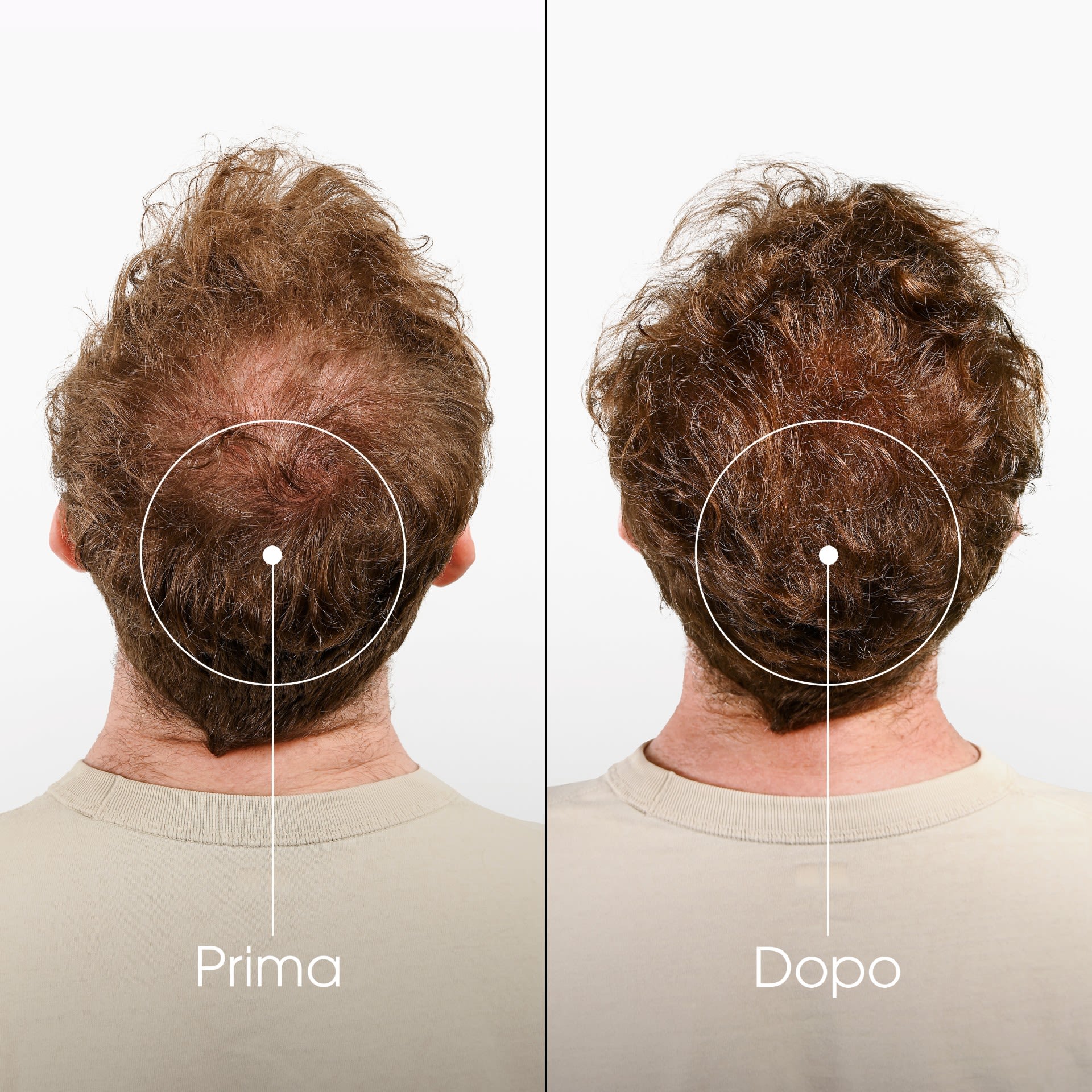 981971082 - KLORANE SHAMPOO CHININA-STELLA ALPINA BIO 200 ML - 4707960_8.jpg