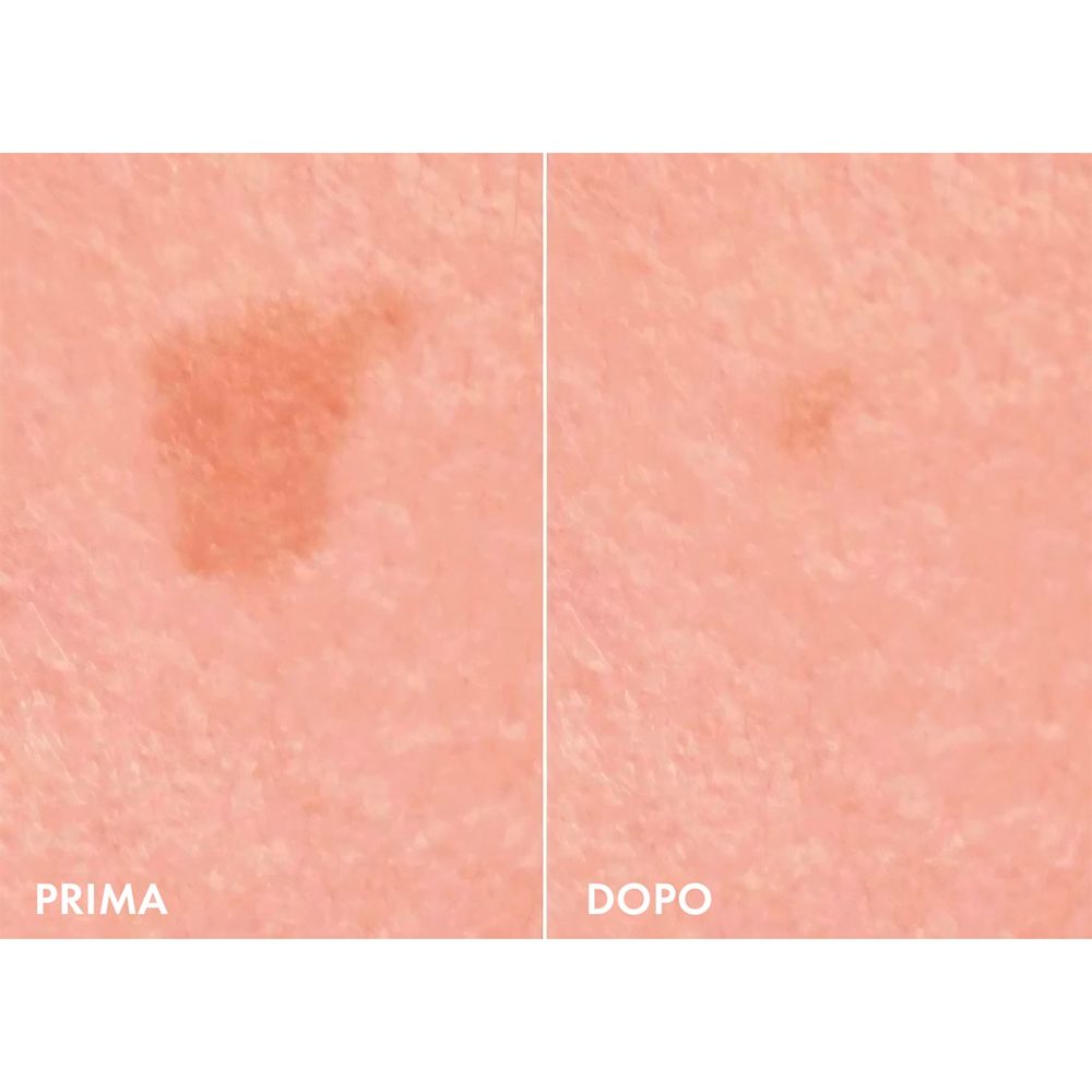 image - 943611626 - LIFTACTIV B3 SPF50 50 ML - 4710971_3.jpg