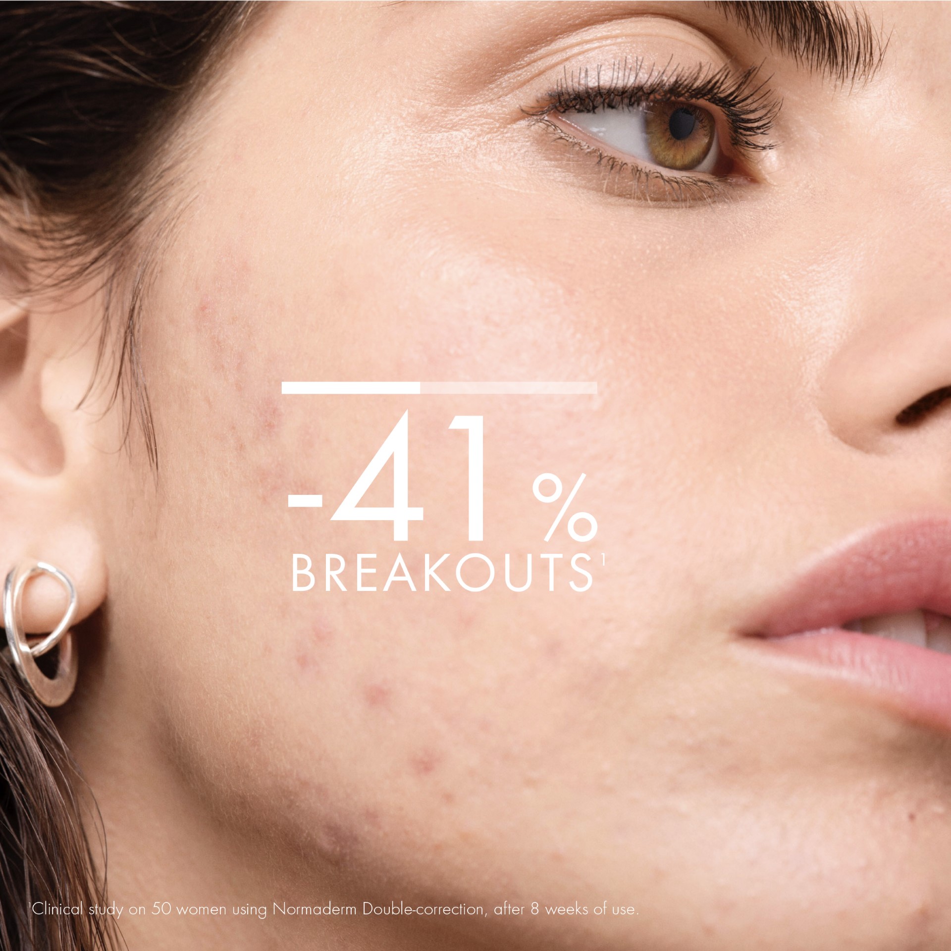 976390563 - NORMADERM PHYTOSOLUTION TRATTAMENTO 50 ML - 7895732_12.jpg