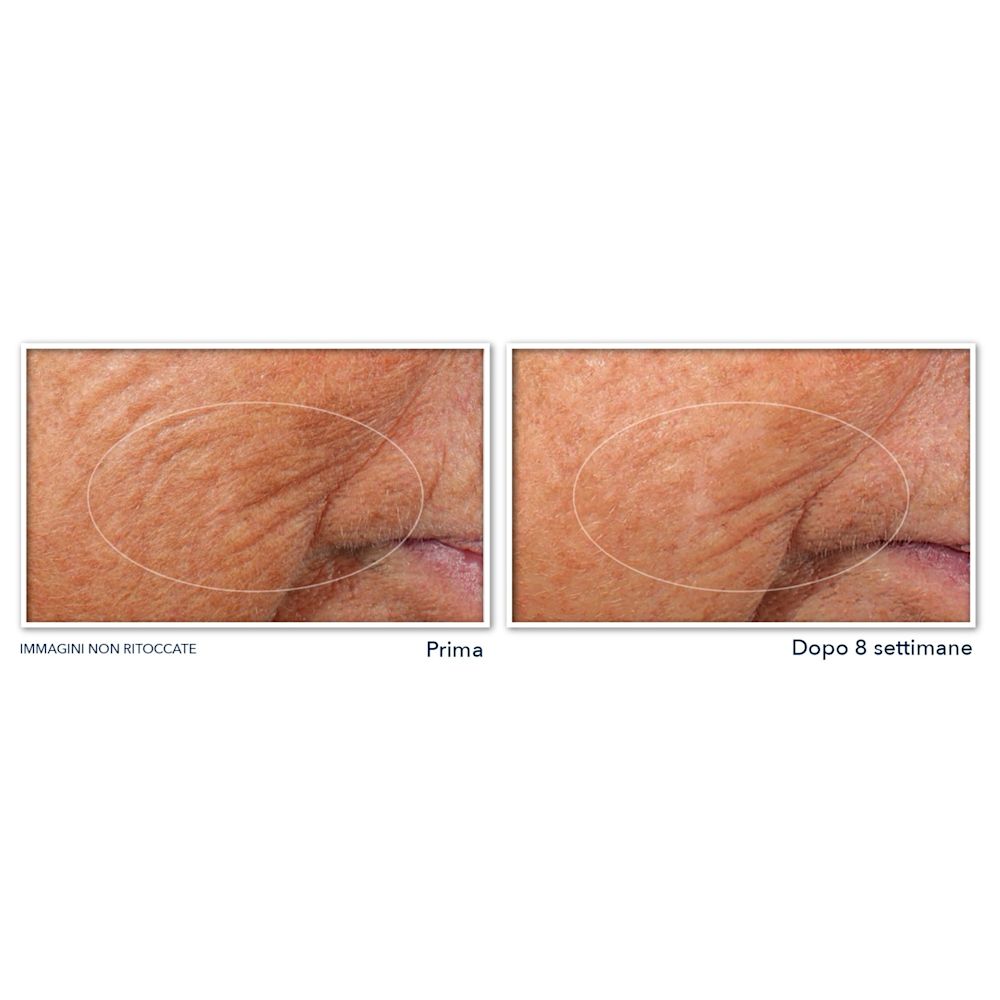 980923116 - ROC RETINOL CORREXION LINE SMOOTHING SIERO VISO NOTTE 30 CAPSULE - 4737046_7.jpg