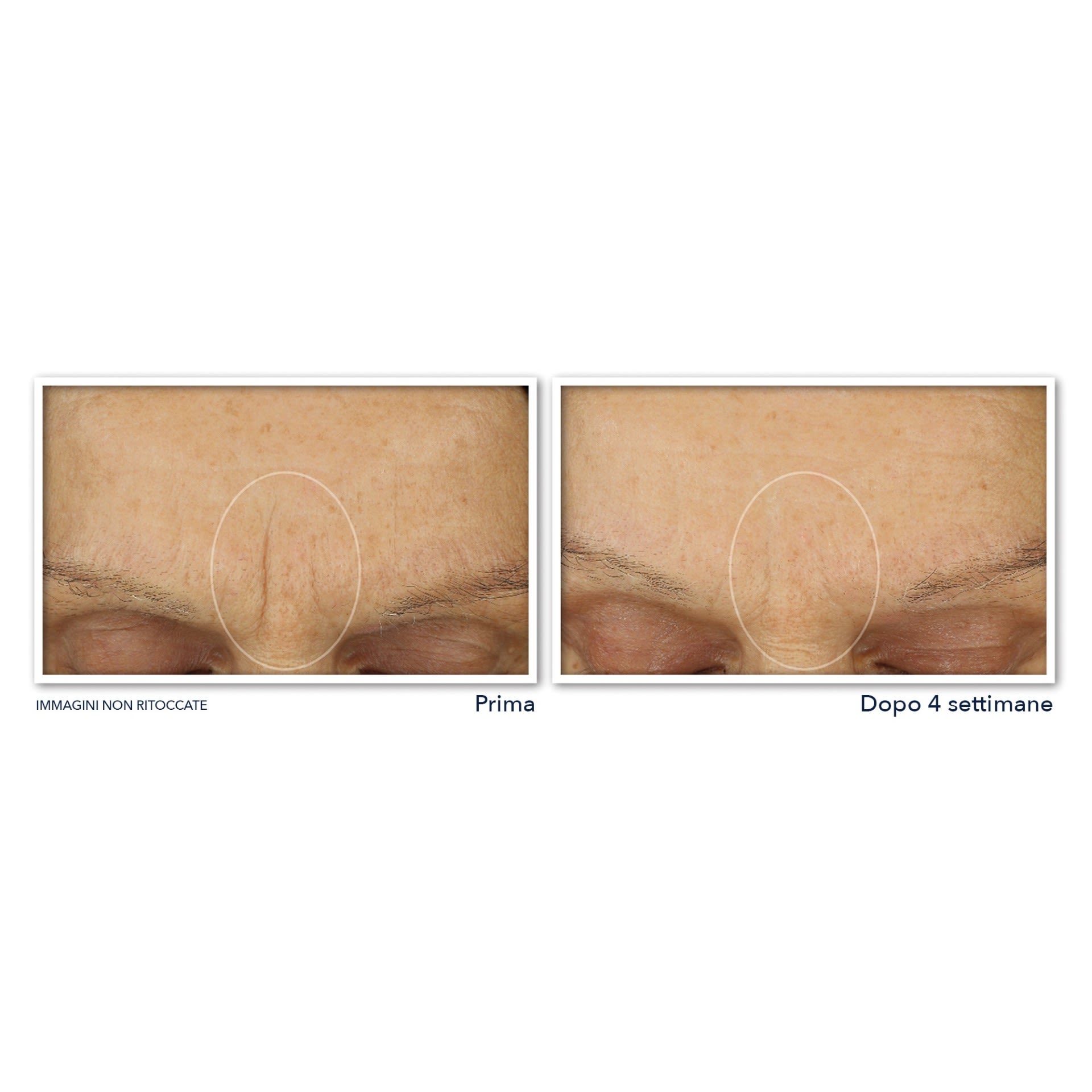 983033667 - ROC RETINOL CORREXION LINE SMOOTHING CREMA VISO 50 ML - 4744300_7.jpg