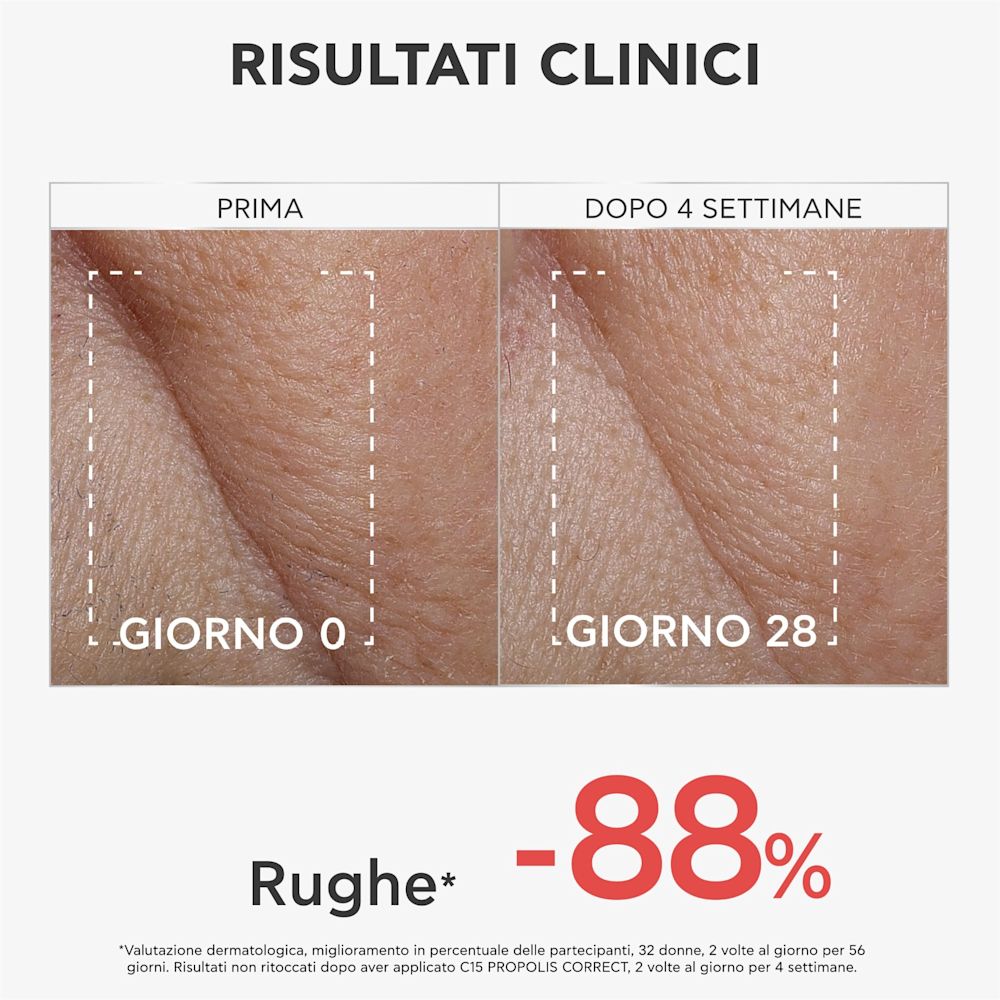 950213076 - APIVITA BEE TECH CONCENTRATE C15 PROPOLIS CORRECT SERUM 30 ML - 4812925_10.jpg