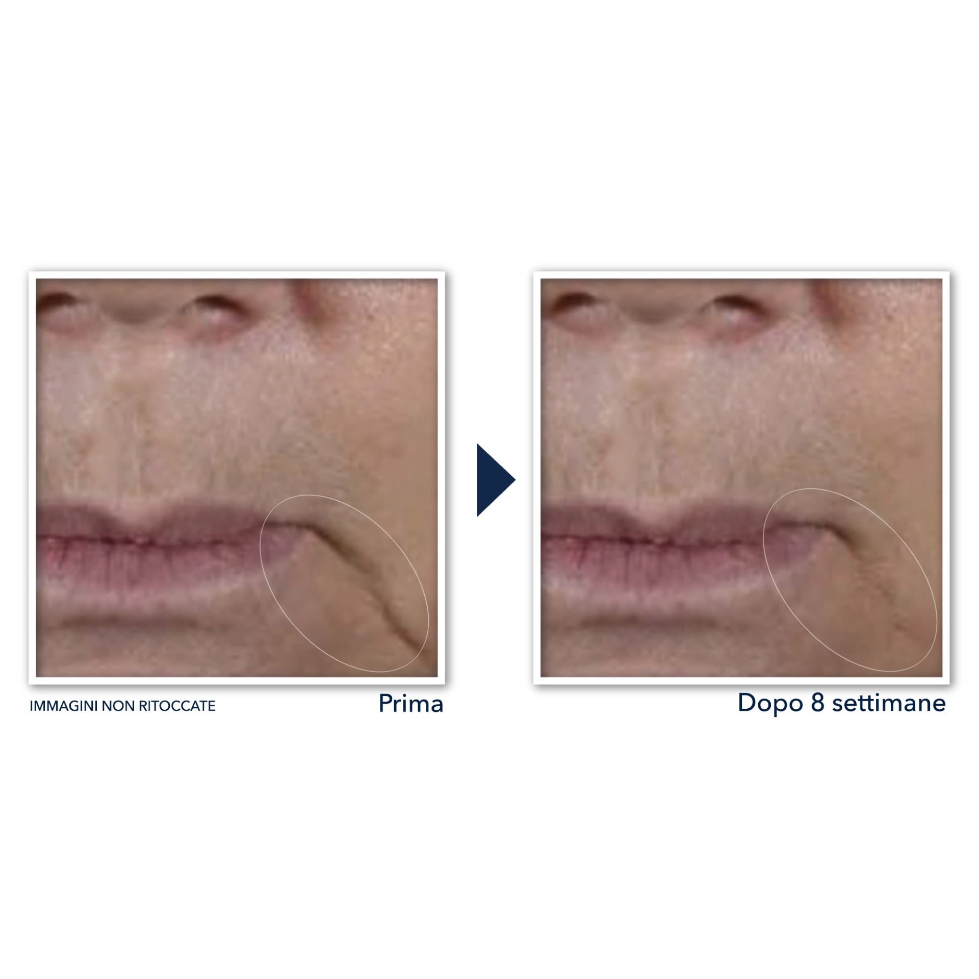 980923181 - ROC MULTI CORREXION FIRM + LIFT CREMA VISO 50 ML - 4737052_7.jpg