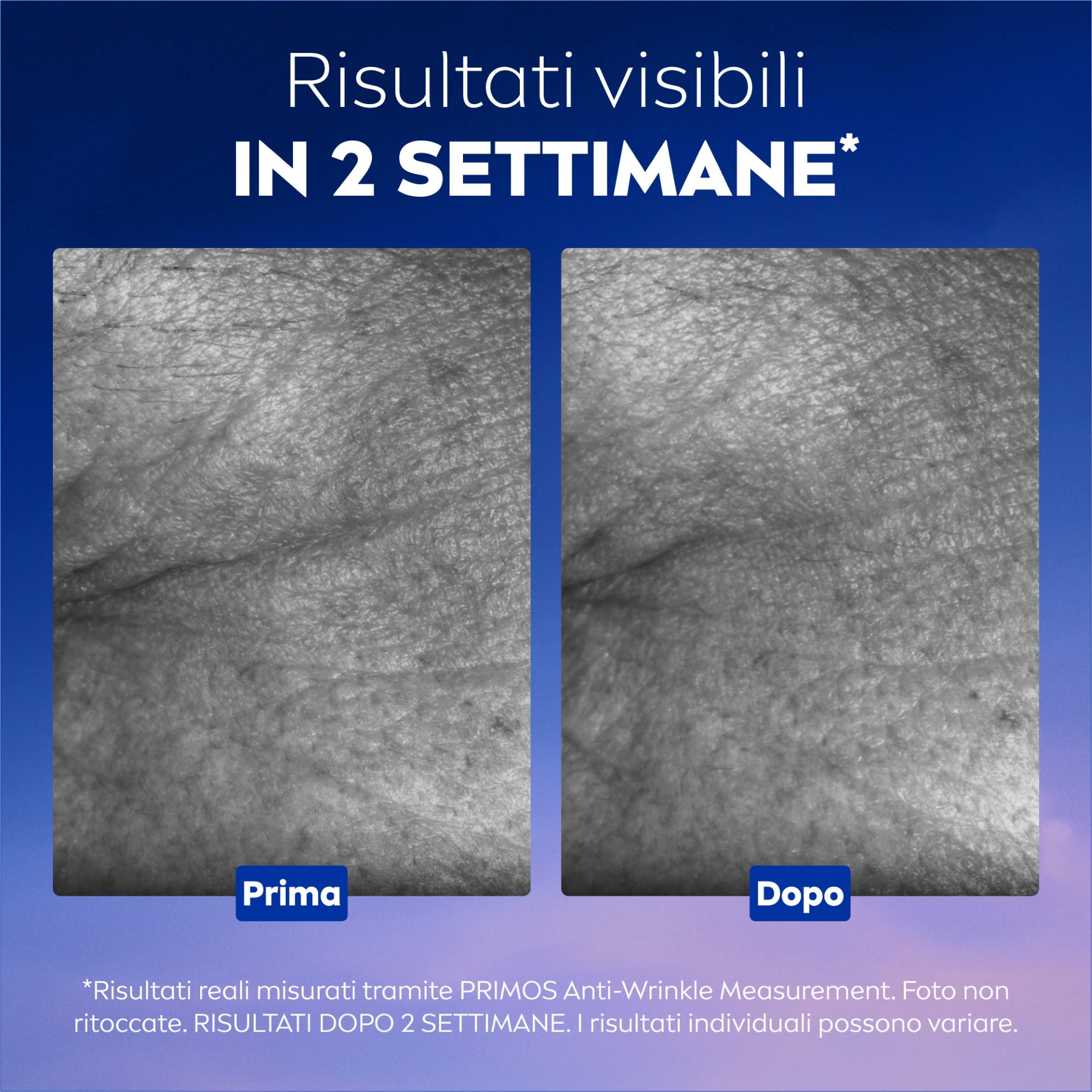 951171990 - NIVEA CELLULAR EPIGENETICS SIERO RINGIOVANENTE 30 ML - 4845502_14.jpg