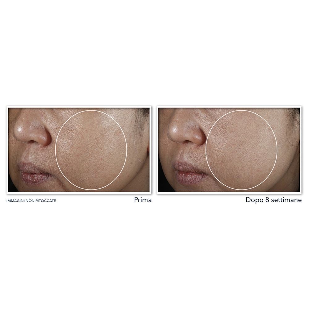 987066949 - ROC MULTI CORREXION EVEN TONE + LIFT NIGHT CREAM 50 ML - 4745728_6.jpg