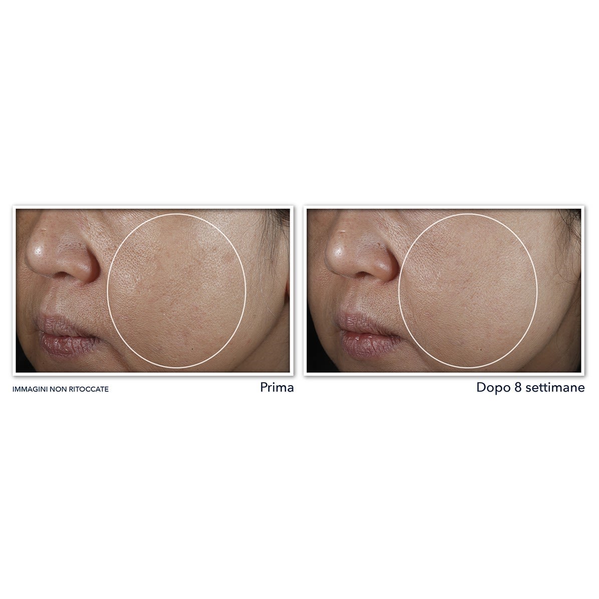 987066949 - ROC MULTI CORREXION EVEN TONE + LIFT NIGHT CREAM 50 ML - 4745728_6.jpg