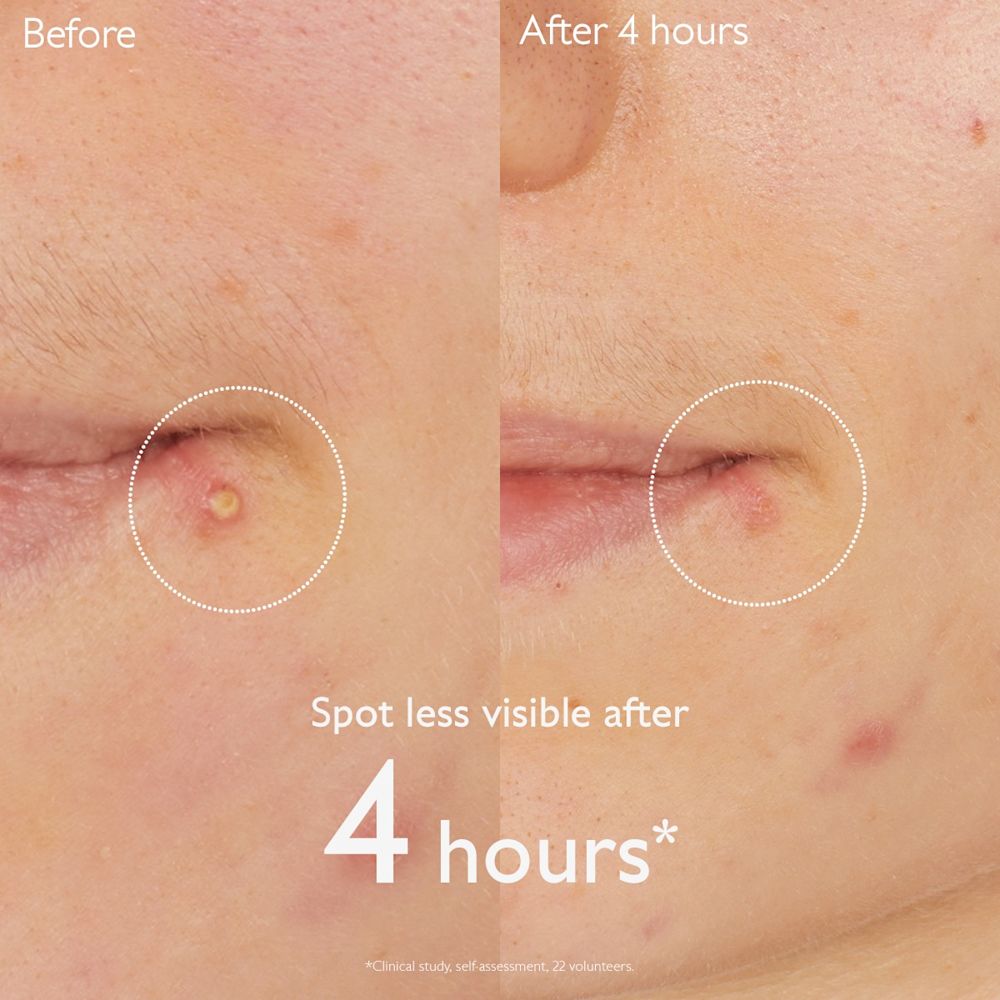 image - 950913653 - VINOPURE SOLUZIONE SALICILICA STOP BRUFOLI 15 ML - 4844548_5.jpg