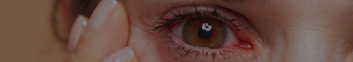 Magazine | Allergie al trucco