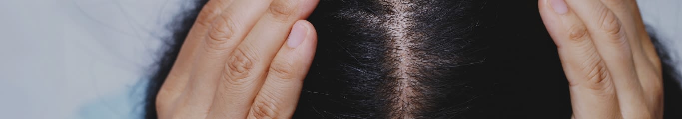 Qual è la differenza tra caduta capelli e caduta capelli stagionale?