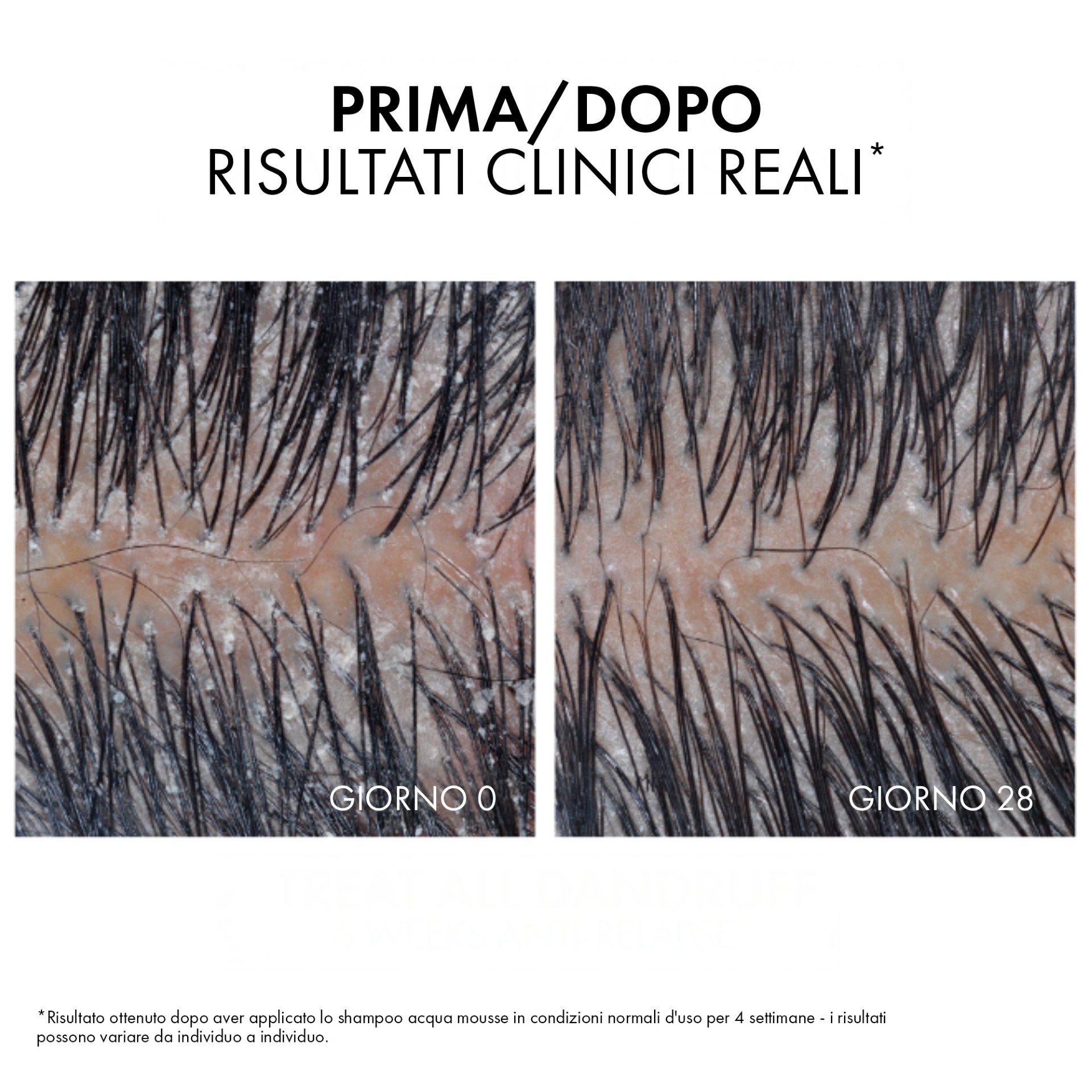 image - 950130652 - DERCOS TECHNIQUE SHAMPOO ANTI DANDRUFF ACQUA MOUSSE 200 ML - 4812573_13.jpg