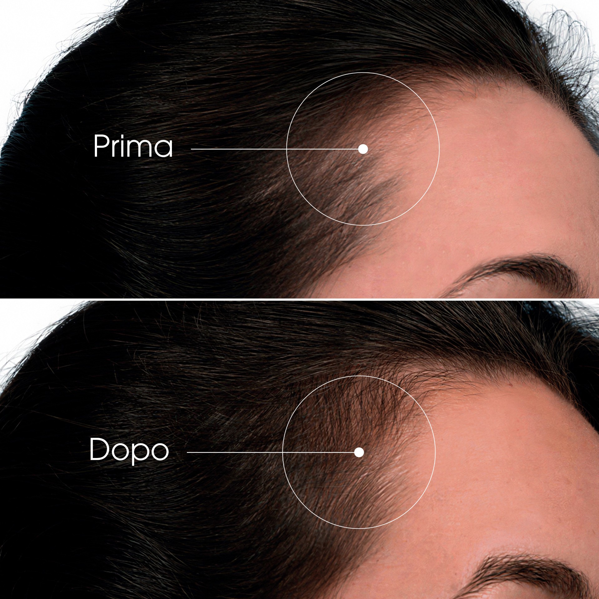 image - 951884283 - Siero intensivo a base di chinina formulato per stimolare la crescita dei capelli e rinforzarli dalla radice. - 4889809_6.jpg